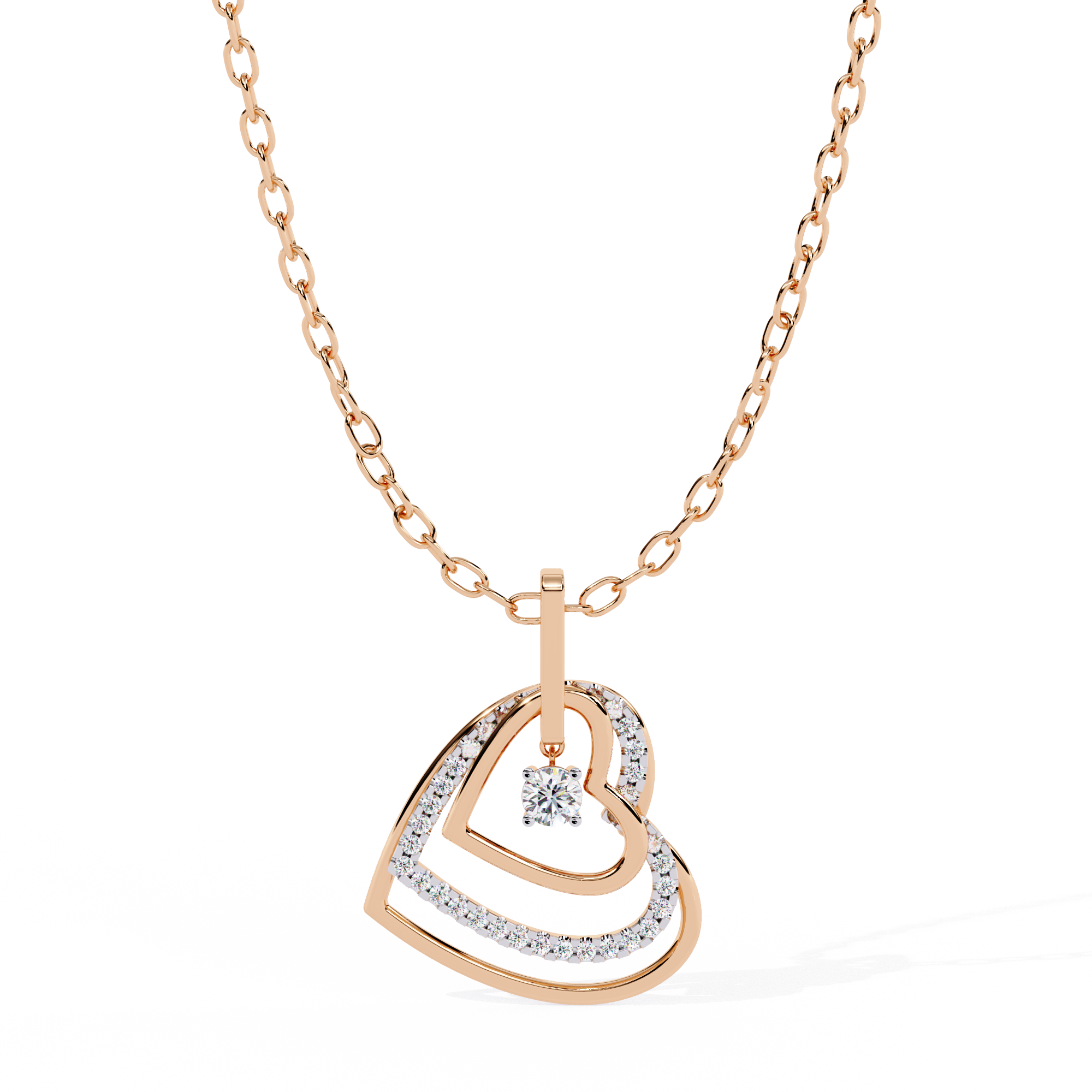 RG1